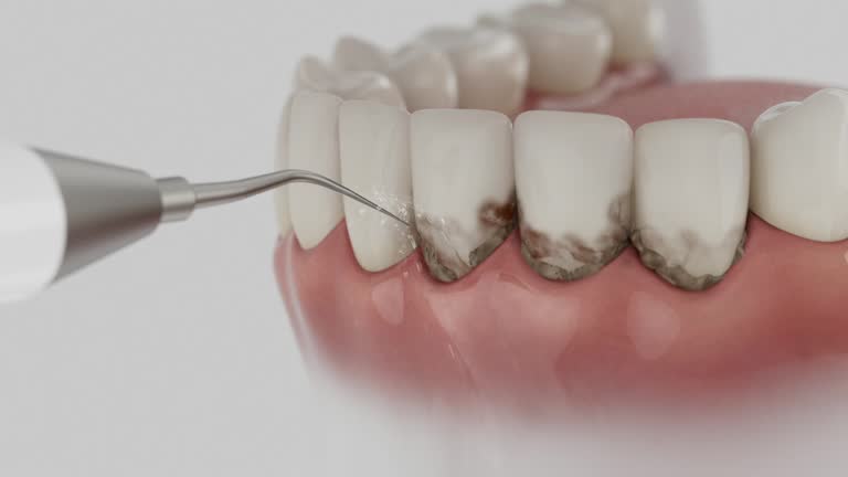 Reliable Teeth Cleaning And Checkup contractor in Chilton County County, AL by Dentist Open Now
